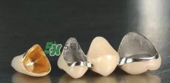 烤瓷牙和全瓷牙有什么區(qū)別?烤瓷牙和全瓷牙的區(qū)別 烤瓷牙和全瓷牙有什么區(qū)別?烤瓷牙和全瓷牙的區(qū)別