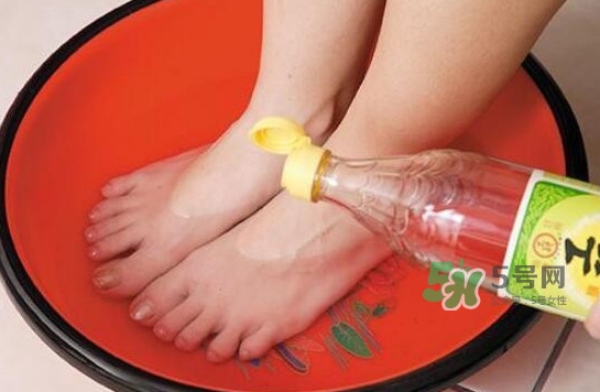 醋泡腳用白醋還是陳醋？泡腳用什么醋最好？