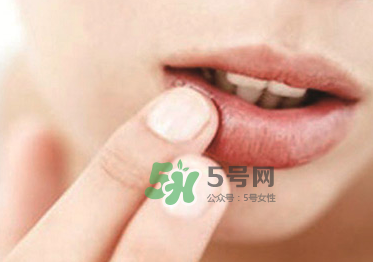 你的嘴唇為什么起泡 嘴唇上的水泡治不好嗎？