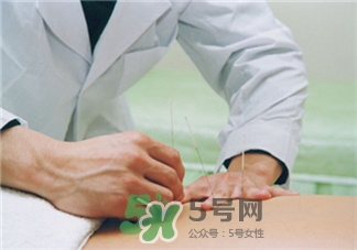 針灸減肥有效嗎?針灸減肥的好處 針灸減肥有效嗎?針灸減肥的好處