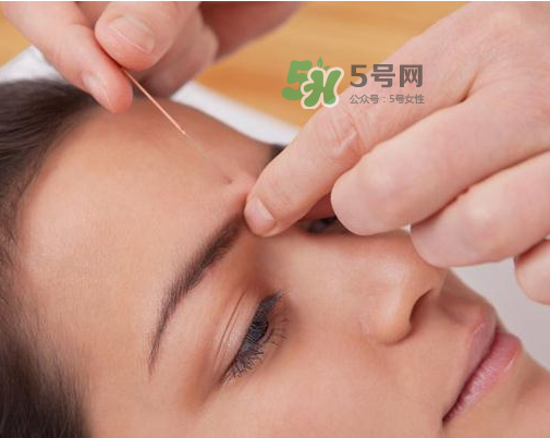 三伏天針灸有什么好處？三伏天針灸注意什么？