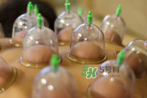 拔火罐是夏天好還是冬天好？什么時候拔火罐最合適？