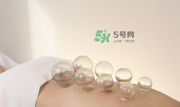 拔火罐是夏天好還是冬天好？什么時候拔火罐最合適？