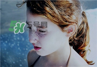 黃褐斑能洗掉嗎?黃褐斑可以用它們洗掉 黃褐斑能洗掉嗎?黃褐斑可以用它們洗掉