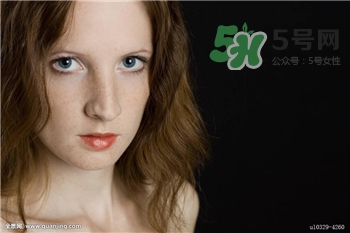 黃褐斑能洗掉嗎?黃褐斑可以用它們洗掉 黃褐斑能洗掉嗎?黃褐斑可以用它們洗掉