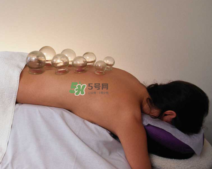 拔火罐一次多長時間？拔火罐一般多長時間？