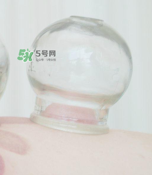 拔火罐一次多長時間？拔火罐一般多長時間？