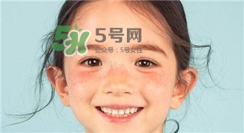 雀斑為什么越來(lái)越多?促使雀斑越來(lái)越多的原因 雀斑為什么越來(lái)越多?促使雀斑越來(lái)越多的原因