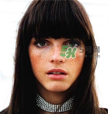 雀斑為什么越來(lái)越多?促使雀斑越來(lái)越多的原因 雀斑為什么越來(lái)越多?促使雀斑越來(lái)越多的原因