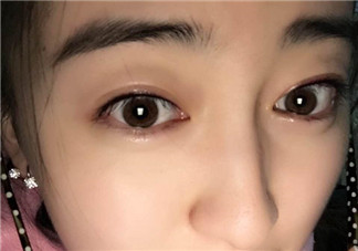 做美瞳線會(huì)不會(huì)掉睫毛？做美瞳線掉睫毛怎么辦？