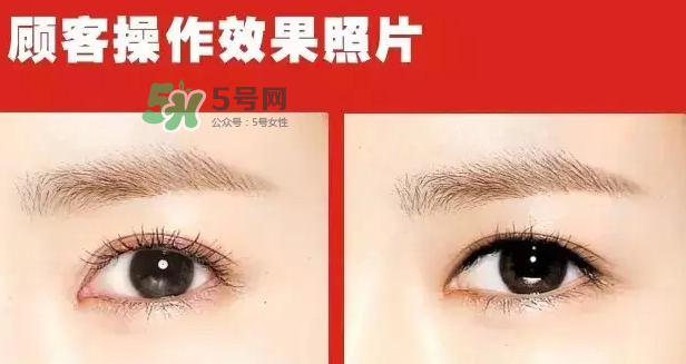 美瞳線有必要做嗎？做美瞳線多少錢？