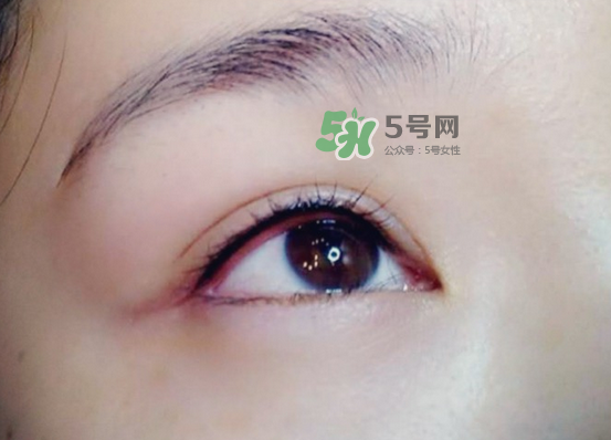 做美瞳線疼嗎？做美瞳線后要注意什么？