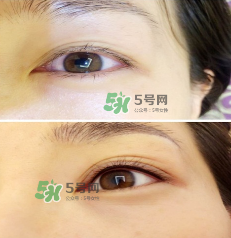 做美瞳線(xiàn)眼睛會(huì)腫嗎?做美瞳線(xiàn)眼睛腫了怎么辦? 做美瞳線(xiàn)眼睛會(huì)腫嗎?做美瞳線(xiàn)眼睛腫了怎么辦?