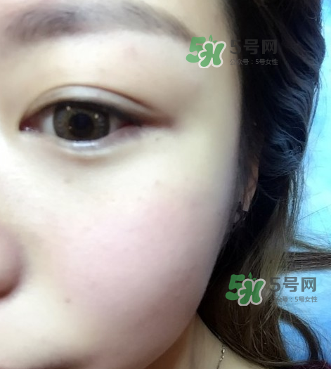 做美瞳線(xiàn)眼睛會(huì)腫嗎?做美瞳線(xiàn)眼睛腫了怎么辦? 做美瞳線(xiàn)眼睛會(huì)腫嗎?做美瞳線(xiàn)眼睛腫了怎么辦?