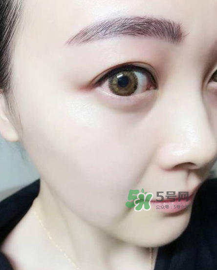 做美瞳線對眼睛有傷害嗎？做美瞳線會傷眼睛嗎？