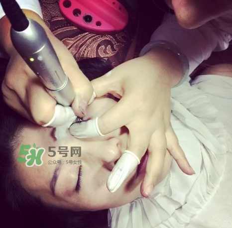 做美瞳線要打麻藥嗎？做美瞳線麻藥怎么敷？