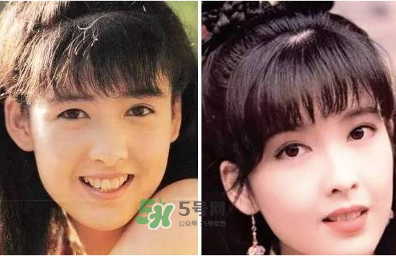 8月份可以割雙眼皮嗎？幾月份割雙眼皮最好？