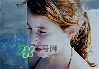 超聲刀后要怎么補(bǔ)水?超聲刀后補(bǔ)水的方法 超聲刀后要怎么補(bǔ)水?超聲刀后補(bǔ)水的方法