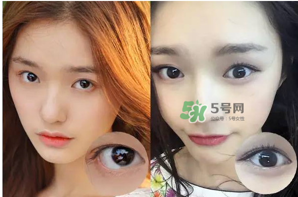 做美瞳線會不會掉睫毛？做美瞳線掉睫毛怎么辦？