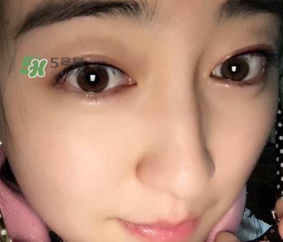 做美瞳線可以喝酒嗎？做美瞳線喝酒有影響嗎？