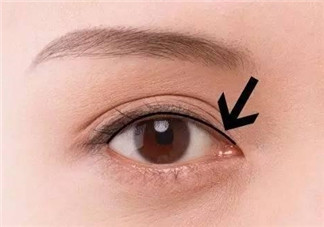 做美瞳線可以吃雞蛋嗎？做美瞳線能吃雞蛋嗎？