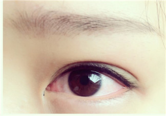 美瞳線有必要做嗎？做美瞳線多少錢？