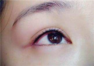 做美瞳線疼嗎？做美瞳線后要注意什么？