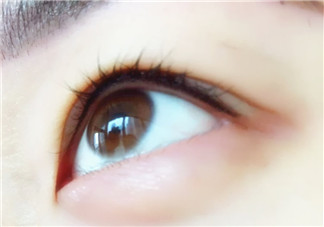 做美瞳線麻藥進(jìn)眼睛怎么辦？做美瞳線麻藥灼傷眼睛怎么辦？