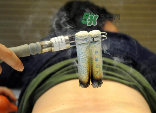 三伏天艾灸后能吹空調(diào)嗎？三伏天艾灸后能吹電扇嗎？