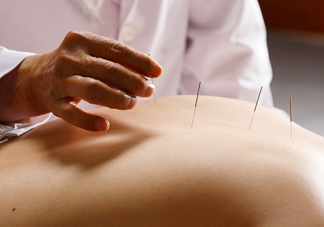 陰天下雨能針灸嗎？陰天下雨可以針灸嗎