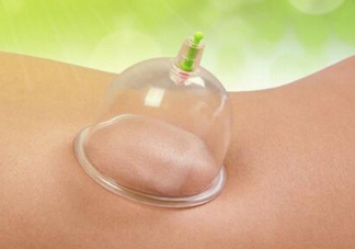 三伏天拔罐后多久可以洗澡？三伏天拔罐后注意事項(xiàng)