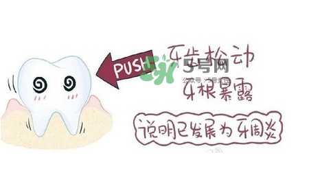 牙齒松動(dòng)會(huì)自己好嗎？牙齒松動(dòng)會(huì)自己掉嗎