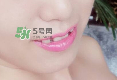 牙齒縫隙大怎么辦？牙縫大帶牙套有用嗎