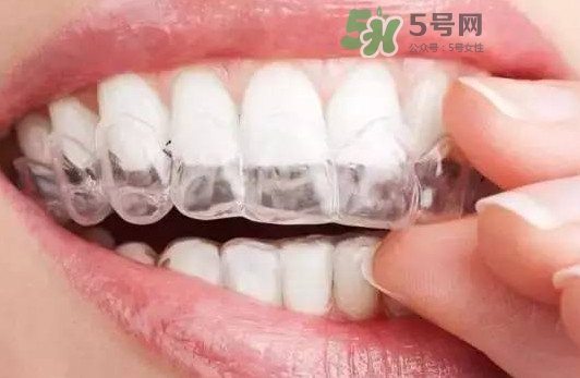 牙齒有縫隙可以補嗎？牙齒縫隙大能補嗎