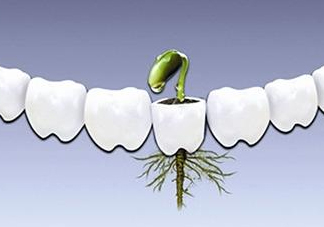 種植牙多少錢一顆？為什么種植牙很貴