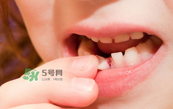 牙齒松動(dòng)可以重新長(zhǎng)牢固嗎？牙齒松動(dòng)可以修復(fù)嗎