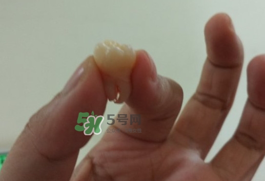 拔智齒痛嗎？智齒拔了多久洞會(huì)好？