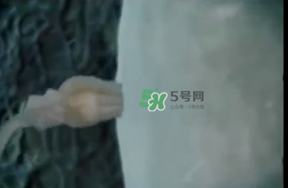 懷孕初期怎么保胎？陰道出血是流產(chǎn)征兆嗎？