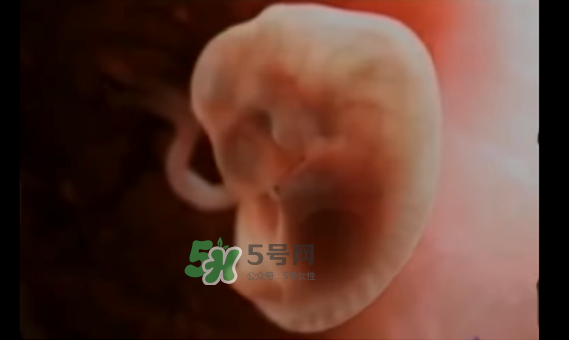 懷孕初期怎么保胎？陰道出血是流產(chǎn)征兆嗎？