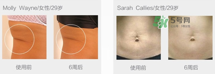 tripollar怎么樣 tripollar怎么用 tripollar怎么樣 tripollar怎么用