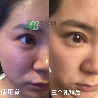 tripollar怎么樣 tripollar怎么用 tripollar怎么樣 tripollar怎么用