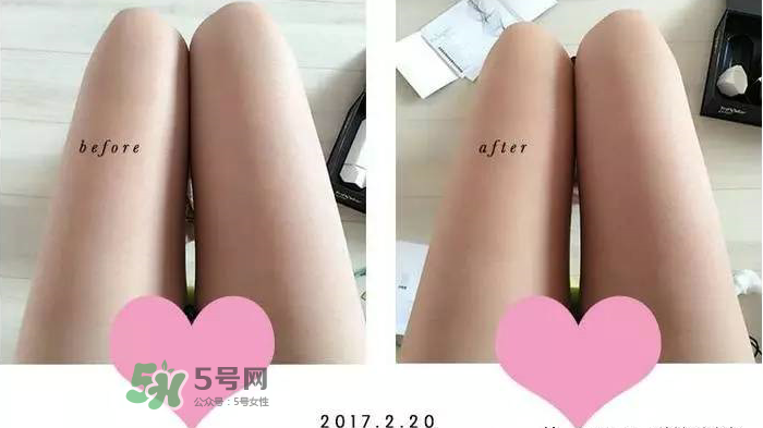 tripollar怎么樣 tripollar怎么用 tripollar怎么樣 tripollar怎么用