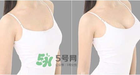 女性乳頭癢是怎么回事？女性乳頭癢要怎么治療？