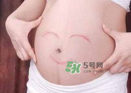 產婦胃脹氣怎么緩解？產婦胃脹氣怎么辦？