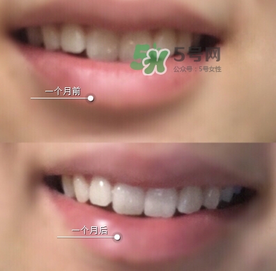 regenerate牙膏白色蓋和金色蓋區(qū)別_哪個(gè)好 regenerate牙膏白色蓋和金色蓋區(qū)別_哪個(gè)好