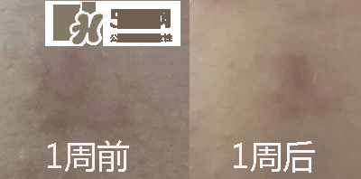 薇姿的護(hù)膚品怎么樣 薇姿屬于什么檔次 薇姿的護(hù)膚品怎么樣 薇姿屬于什么檔次