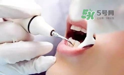 孕婦能矯正牙齒嗎？懷孕期間可以矯正牙齒嗎？