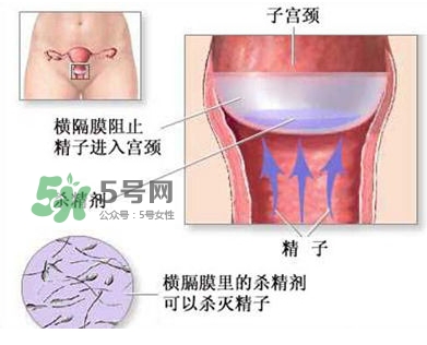 殺精劑避孕可靠嗎？殺精劑避孕要注意什么？