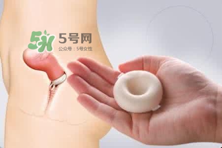 殺精劑有什么副作用？殺精劑的使用方法