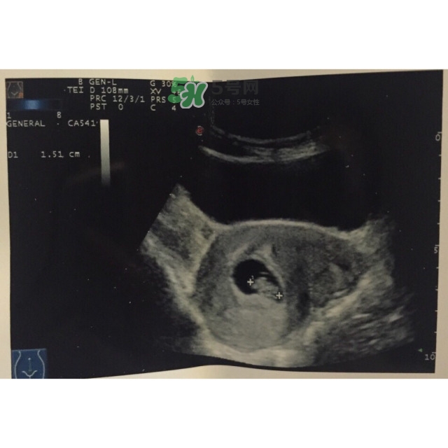 懷孕40周檢查項目 超級詳細孕期檢查攻略 懷孕40周檢查項目 超級詳細孕期檢查攻略